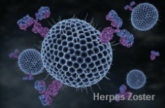 Herpes_Zoster causes outbreaks.