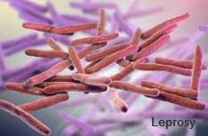 Leprosy causes pandemics.