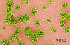 MRSA causes outbreaks.