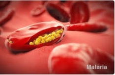 Malaria - contagious.