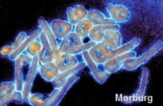 Marburg_Virus needs a better vaccine.