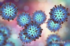 Rubeola - infectious.