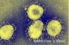 SARS-Cov-1_Virus causes pandemics.